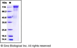 Sino Biological Human cytomegalovirus (HCMV) Glycoprotein B / gB Protein