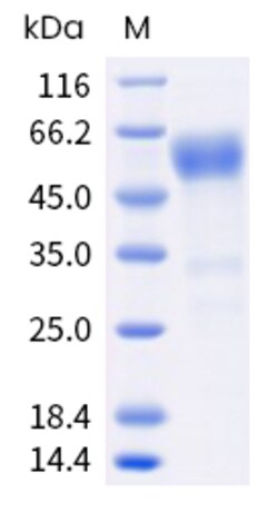Sino Biological Human DKK3 Protein 100ug (Sino Biological), Quantity: Each
