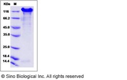 Sino Biological Human E-Cadherin / CDH1 / E-cad / CD324 Protein (Fc Tag),
