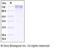 Sino Biological Recombinant Human ECE2 Protein (hFc Tag), Quantity: Each