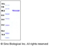 Sino Biological Human Layilin / LAYN Protein (Fc Tag) 100ug, Quantity: