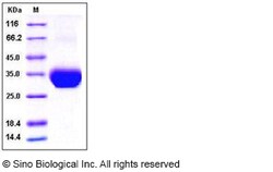 Sino Biological Recombinant Human LAYN Protein (His Tag), HPLC-verified,