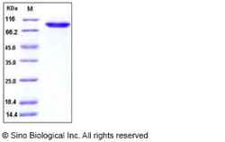 Sino Biological Recombinant Human DDR2 Protein (hFc Tag), Quantity: Each