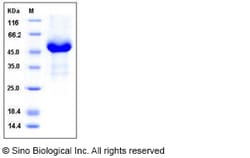 Sino Biological Recombinant Human GFR Alpha-3/GFRA3 Protein (His Tag),