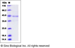 Sino Biological Recombinant Human Dectin-1/CLEC7A Protein (hFc Tag), HPLC-verified,