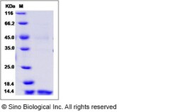 Sino Biological Recombinant Human Dectin-1/CLEC7A Protein, HPLC-verified,