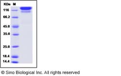 Sino Biological Recombinant Human Fas/CD95/TNFRSF6 Protein (hFc Tag), Quantity: