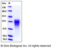 Sino Biological Recombinant Human Fas/CD95/TNFRSF6 Protein (ECD, His Tag),