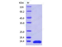 Sino Biological Recombinant Human Leptin Protein 100 µg, Quantity: Each