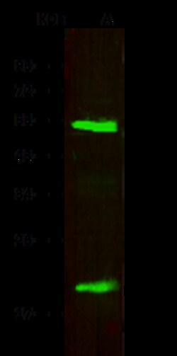 Sino Biological Recombinant Anti-Lipocalin-2/NGAL Antibody, Rabbit Monoclonal,
