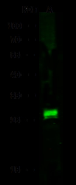 Sino Biological Anti-Lipocalin-2/NGAL Antibody, Rabbit Polyclonal, Quantity: