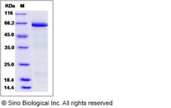 Sino Biological Human DCR3 / TNFRSF6B Protein (Fc Tag) 1mg, Quantity: Each