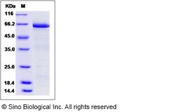 Sino Biological Recombinant Human DcR3/TNFRSF6B Protein (hFc Tag), Quantity: