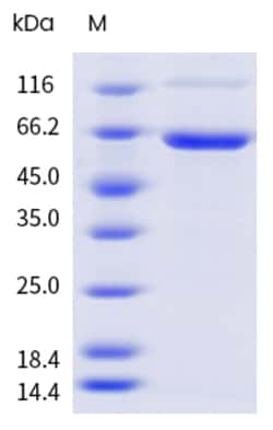 Sino Biological&nbsp;Recombinant Human DcR3/TNFRSF6B Protein (ECD, hFc & AVI Tag), Avi-tag Biotinylated 20 µg
