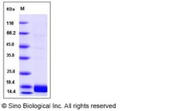 Sino Biological Recombinant Human ACVR1 Protein (His Tag), HPLC-verified,
