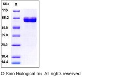 Sino Biological Human ACVR2B / ActivinR-IIB Protein (ECD, Fc Tag) 100ug,