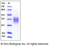 Sino Biological Recombinant Human ACVR2B Protein (His Tag), HPLC-verified,