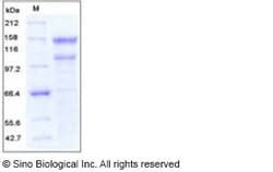 Sino Biological Recombinant Human LDLR/LDL Receptor Protein (His Tag),