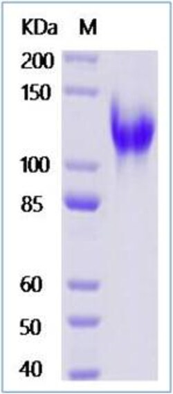 Sino Biological Recombinant Human LDLR/LDL Receptor Protein (193D/A, ECD,