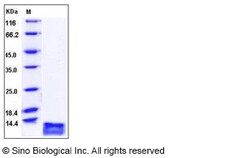 Sino Biological Recombinant Human TARC/CCL17 Protein (His Tag), Quantity: