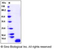 Sino Biological Recombinant Human TARC/CCL17 Protein, Quantity: Each of