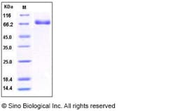 Sino Biological Recombinant Human EphB4 Protein (His Tag), HPLC-verified