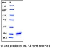 Sino Biological Human CD40L / CD154 / TNFSF5 Protein (His Tag) 100ug, Quantity:
