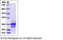 Sino Biological Human Fas Ligand / FASLG / CD95L Protein (His Tag) 50ug,