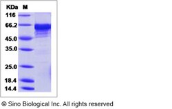 Sino Biological Recombinant Human methionyl aminopeptidase 2/METAP2 Protein