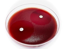 Liofilchem&trade;&nbsp;Brucella Blood Agar With Hemin and Vitamin K1