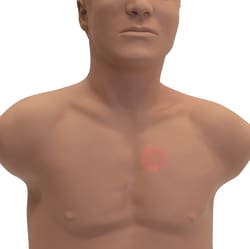 3B Scientific&trade;&nbsp;SAM4 Plus Auscultation Manikin Light Skin