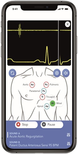 3B Scientific&trade;&nbsp;SAM4 Plus Auscultation Manikin Light Skin
