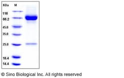 Sino Biological Recombinant Human MMP-8 Protein (His Tag), Quantity: Each
