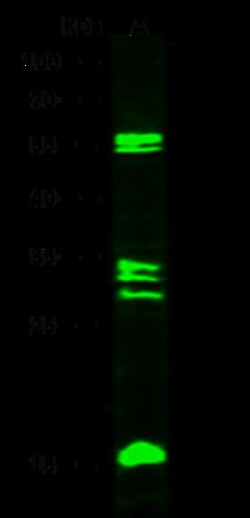 Sino Biological Anti-MMP-8 Antibody, Rabbit Polyclonal, Quantity: Each