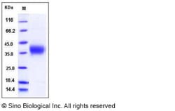 Sino Biological Recombinant Human ACVR2A Protein (His Tag), HPLC-verified,