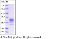 Sino Biological Recombinant Human CD32B/Fcgr2b Protein (ECD, His Tag),
