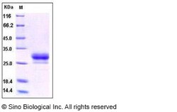 Sino Biological Recombinant Human CD32B/Fcgr2b Protein (ECD, His Tag),