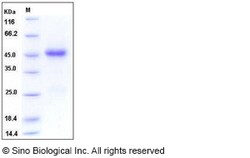Sino Biological Recombinant Human NOV/CCN3 Protein (His Tag), Quantity: