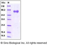 Sino Biological Recombinant Human Noggin/NOG Protein (hFc Tag) 1 mg, Quantity:
