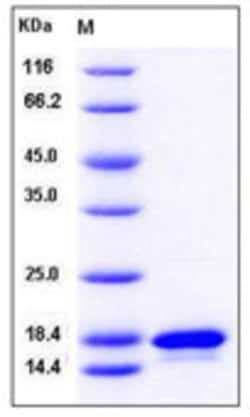 Sino Biological Human TNF-beta / TNFSF1 / Lymphotoxin alpha Protein 1mg,