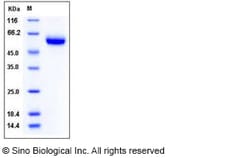 Sino Biological Recombinant Human Osteoprotegerin/TNFRSF11B Protein (His