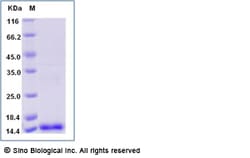 Sino Biological Human PIGF / PLGF / PGF Protein (aa 19-149) 100ug, Quantity: