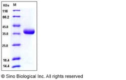 Sino Biological Recombinant Human Prolactin Receptor Protein (His Tag),