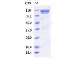 Sino Biological Recombinant Human AXL Protein (ECD, mFc Tag), HPLC-verified,