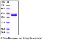 Sino Biological Recombinant Human Prostasin/PRSS8 Protein (His Tag), Quantity: