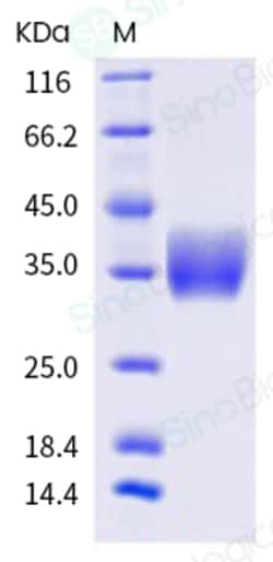 Sino Biological Human Galectin 3 / LGALS3 Protein (His Tag) 100ug, Quantity: