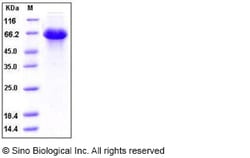 Sino Biological Recombinant Human SerpinD1 Protein (His Tag), Quantity: