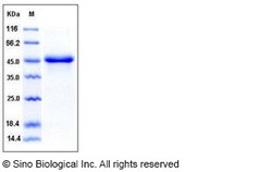 Sino Biological Recombinant Cynomolgus, Rhesus NKG2A Protein (hFc Tag),