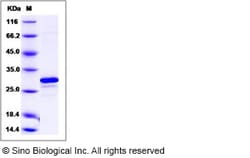 Sino Biological Recombinant Human Mer Protein (aa 578-872), Quantity: Each