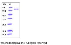 Sino Biological Human Periostin / POSTN Protein (His Tag) 100ug, Quantity: